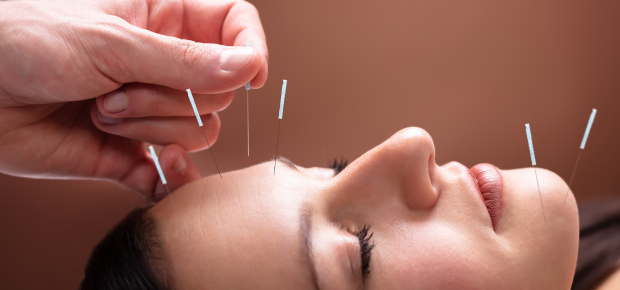 studying acupunture in australia with natural therapy pages